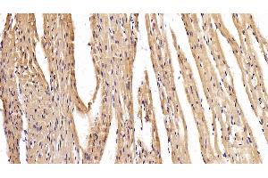 Detection of MYH2 in Mouse Cardiac Muscle Tissue using Polyclonal Antibody to Myosin Heavy Chain 2 (MYH2)