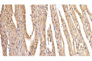 Detection of MYH2 in Mouse Cardiac Muscle Tissue using Polyclonal Antibody to Myosin Heavy Chain 2 (MYH2) (MYH2 anticorps  (AA 1238-1472))