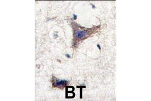 Formalin-fixed and paraffin-embedded human brain tissue reacted with SPRED1 polyclonal antibody  , which was peroxidase-conjugated to the secondary antibody, followed by DAB staining. (SPRED1 anticorps  (C-Term))
