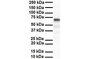 WB Suggested Anti-SLC5A5 antibody Titration: 1 ug/mL Sample Type: Human liver (SLC5A5 anticorps  (N-Term))