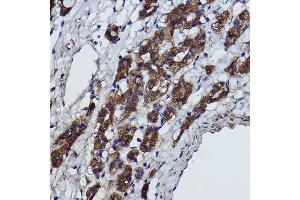 Immunohistochemistry of paraffin-embedded Rat heart using α-Smooth Muscle Actin  Rabbit pAb (ABIN6127402, ABIN6136473, ABIN6136476 and ABIN6214239) at dilution of 1:25 (40x lens). (Smooth Muscle Actin anticorps  (AA 1-124))
