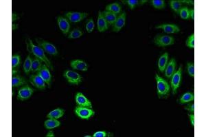 Immunofluorescent analysis of HepG2 cells using ABIN7162535 at dilution of 1:100 and Alexa Fluor 488-congugated AffiniPure Goat Anti-Rabbit IgG(H+L)