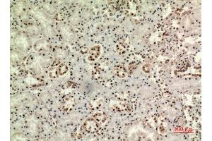 Immunohistochemistry (IHC) analysis of paraffin-embedded Human Kidney, antibody was diluted at 1:100.