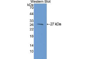 Western blot analysis of the recombinant protein. (GSTM1 anticorps  (AA 1-218))