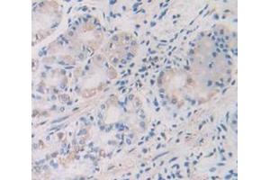 Figure. (TMPRSS2 anticorps  (AA 284-492))