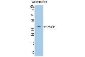Western Blotting (WB) image for anti-alpha-1-B Glycoprotein (A1BG) (AA 313-513) antibody (ABIN1857839) (A1BG anticorps  (AA 313-513))