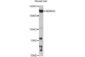 Western blot analysis of extracts of mouse liver, using SEMA5A antibody. (SEMA5A anticorps)