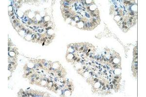 anti-Lysine (K)-Specific Demethylase 4D (KDM4D) (C-Term) antibody