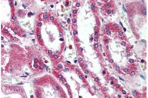 Human Kidney (formalin-fixed, paraffin-embedded) stained with SIRT5 antibody ABIN290374 at 5 ug/ml followed by biotinylated goat anti-rabbit IgG secondary antibody ABIN481713, alkaline phosphatase-streptavidin and chromogen. (SIRT5 anticorps  (AA 30-46))