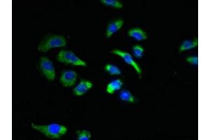 Immunofluorescent analysis of A549 cells using ABIN7170048 at dilution of 1:100 and Alexa Fluor 488-congugated AffiniPure Goat Anti-Rabbit IgG(H+L) (NKAIN4 anticorps  (AA 83-150))