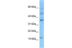 WB Suggested Anti-ID3 Antibody Titration: 1. (ID3 anticorps  (N-Term))