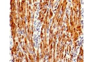 Formalin-fixed, paraffin-embedded human uterus stained with Calponin antibody (RMCN1-1). (Recombinant Calponin anticorps)
