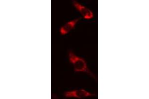 ABIN6274166 staining HeLa cells by IF/ICC.