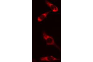 ABIN6274166 staining HeLa cells by IF/ICC. (HARS1/Jo-1 anticorps  (C-Term))