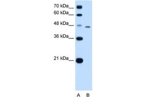 Western Blotting (WB) image for anti-TAP Binding Protein (Tapasin) (TAPBP) antibody (ABIN2462853) (TAPBP anticorps)