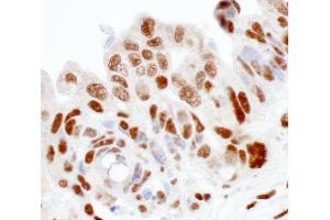Immunohistochemistry (IHC) image for anti-Sjogren Syndrome Antigen B (SSB) (AA 358-408) antibody (ABIN7453946) (SSB anticorps  (AA 358-408))