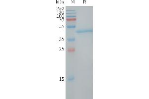 Human LY6H Protein, hFc Tag on SDS-PAGE under reducing condition.