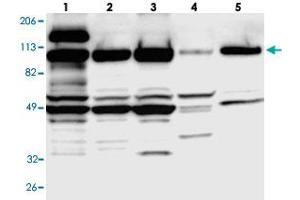 Western blot analysis of Lane 1: RT-4, Lane 2: U-251 MG, Lane 3: A-431, Lane 4: Liver, Lane 5: Tonsil with SMEK1 polyclonal antibody . (SMEK1 anticorps)