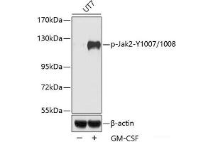 Western blot analysis of extracts of UT7 cells using Phospho-Jak2(Y1007/1008) Polyclonal Antibody. (JAK2 anticorps  (pTyr1007, pTyr1008))