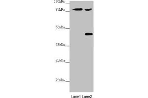 Western blot All lanes: SPICE1 antibody at 5. (SPICE1 anticorps  (AA 1-220))