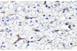 Immunohistochemistry of paraffin-embedded Human liver using CD44 Polyclonal Antibody at dilution of 1:100 (40x lens). (CD44 anticorps)
