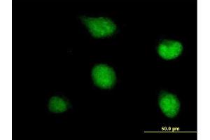Immunofluorescence of purified MaxPab antibody to ZNF278 on HeLa cell. (PATZ1 anticorps  (AA 1-537))