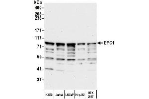 anti-Enhancer of Polycomb Homolog 1 (EPC1) (AA 325-375) antibody