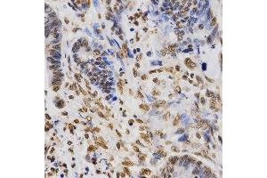 Immunohistochemistry (IHC) image for anti-Histone H3 (H3) (H3K36me3) antibody (ABIN3016039)