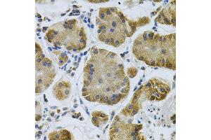 Immunohistochemistry of paraffin-embedded human stomach using IGFBP4 Antibody.