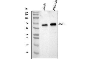Western blot analysis of PAK3 using anti-PAK3 antibody (ABIN3044532).