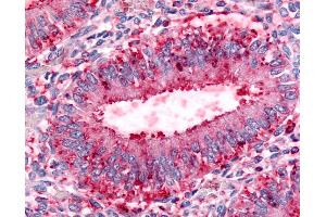 Anti-DPP8 antibody IHC of human uterus, endometrial glands.