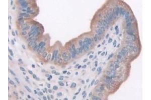 Detection of LEPR in Mouse Uterus Tissue using Polyclonal Antibody to Leptin Receptor (LEPR)