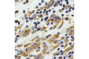 Immunohistochemical analysis of Chitotriosidase staining in human stomach formalin fixed paraffin embedded tissue section. (Chitotriosidase 1 anticorps)