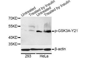 Western blot analysis of extracts of 293 and HeLa cells, using Phospho-GSK3A-S21 antibody. (GSK3 alpha anticorps  (pSer21))