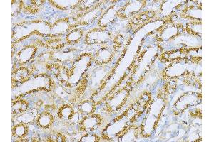 Immunohistochemistry of paraffin-embedded Mouse kidney using Aconitase 2  antibody (ABIN1678537, ABIN3017991, ABIN3017992 and ABIN6220329) at dilution of 1:100 (40x lens).