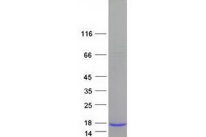 Validation with Western Blot