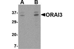 Western Blotting (WB) image for anti-ORAI Calcium Release-Activated Calcium Modulator 3 (ORAI3) (C-Term) antibody (ABIN1030564) (ORAI3 anticorps  (C-Term))