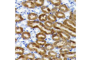 Immunohistochemistry of paraffin-embedded mouse kidney using NQO1 antibody (ABIN7268795) at dilution of 1:100 (40x lens). (NQO1 anticorps)