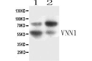 Western blot analysis of VNN1 expression in SKOV3 whole cell lysates ( Lane 3) and HELA whole cell lysates ( Lane 4).