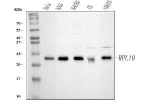 Western blot analysis of RPL10 using anti-RPL10 antibody (ABIN7601177).