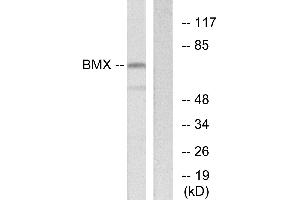 Immunohistochemistry analysis of paraffin-embedded human thyroid gland tissue using BMX antibody. (BMX anticorps  (N-Term))