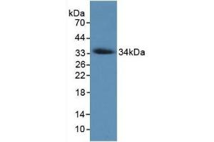 Detection of Recombinant COL7, Human using Monoclonal Antibody to Collagen Type VII (COL7)