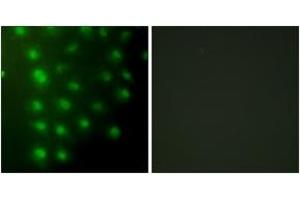 Immunofluorescence analysis of HuvEc cells, using AKAP8 Antibody.