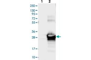 Western blot analysis of Lane 1: Negative control (vector only transfected HEK293T lysate), Lane 2: Over-expression Lysate (Co-expressed with a C-terminal myc-DDK tag (~3. (SIKE1 anticorps)