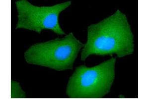 ICC/IF analysis of FSCN1 in HeLa cells line, stained with DAPI (Blue) for nucleus staining and monoclonal anti-human FSCN1 antibody (1:100) with goat anti-mouse IgG-Alexa fluor 488 conjugate (Green).