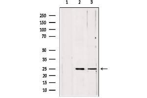 Western blot analysis of extracts from various samples, using PLDN antibody. (Pallidin anticorps  (C-Term))