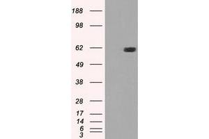 HEK293T cells were transfected with the pCMV6-ENTRY control (Left lane) or pCMV6-ENTRY STK39 (Right lane) cDNA for 48 hrs and lysed. (STK39 anticorps)