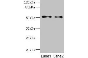Western blot All lanes: TUBB3 antibody at 6 μg/mL Lane 1: A549 whole cell lysate Lane 2: A431 whole cell lysate Secondary Goat polyclonal to rabbit IgG at 1/10000 dilution Predicted band size: 51, 43 kDa Observed band size: 51 kDa (TUBB3 anticorps  (AA 1-210))