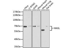Western blot analysis of extracts of various cell lines, using WASL antibody. (Neural Wiskott-Aldrich syndrome protein (WASL) (AA 1-250) anticorps)
