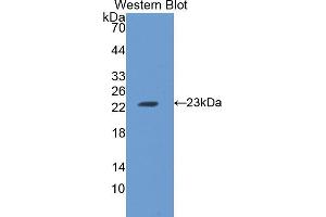 Western blot analysis of the recombinant protein. (FTH1 anticorps  (AA 1-182))